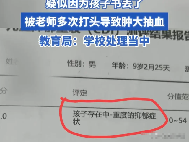 岂有此理！男孩丢课本被女老师虐待，头部严重变形，对方拒不道歉